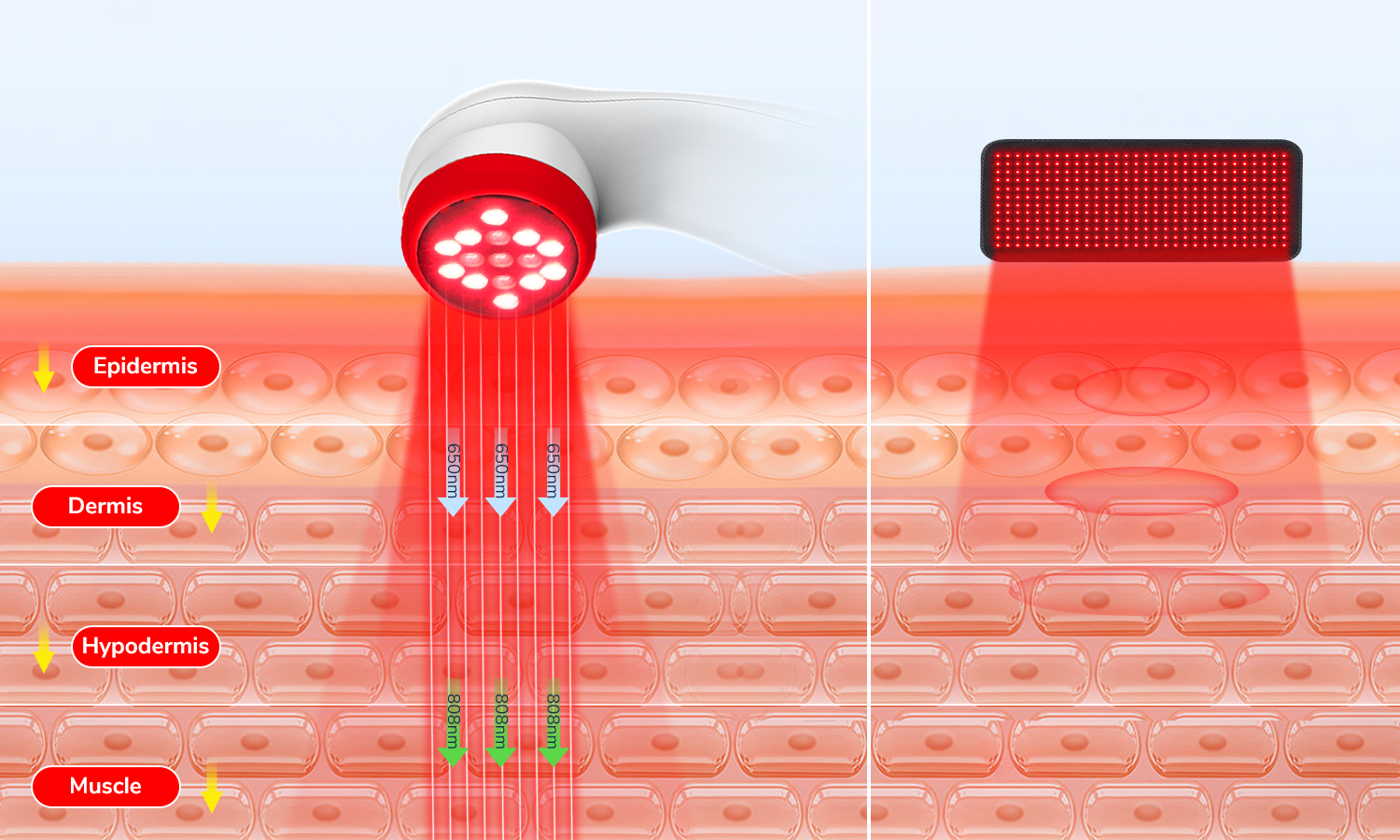 Cold Laser vs. Red Light Therapy: What’s Better for Chronic Pain?