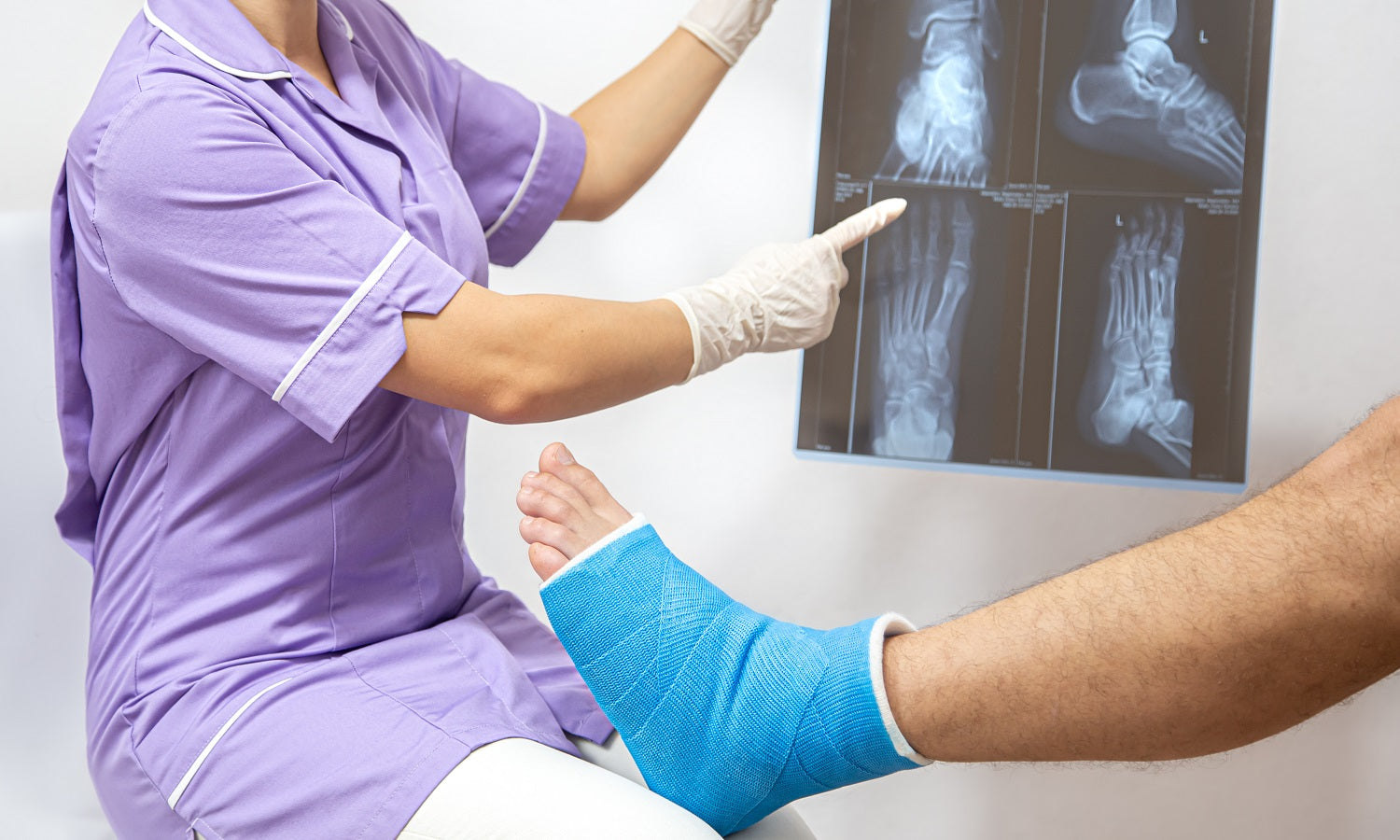 Can LLLT Aid in the Healing of Bone Fractures?