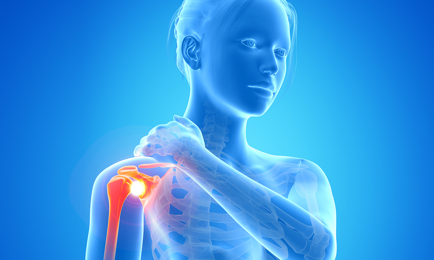 Highlight medical illustration of frozen shoulder showing restricted joint movement and inflammation