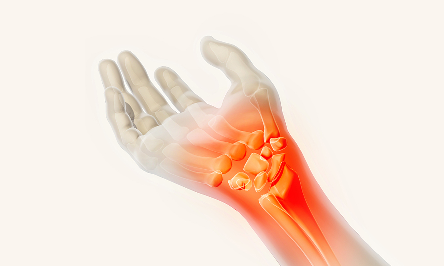 Anatomical illustration of a wrist showing ligaments, bones, and common areas affected by sprains